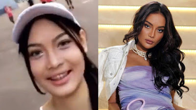 Perbedaan Wajah Erika Carlina Sebelum dan Sesudah Oplas, Netizen Heboh!